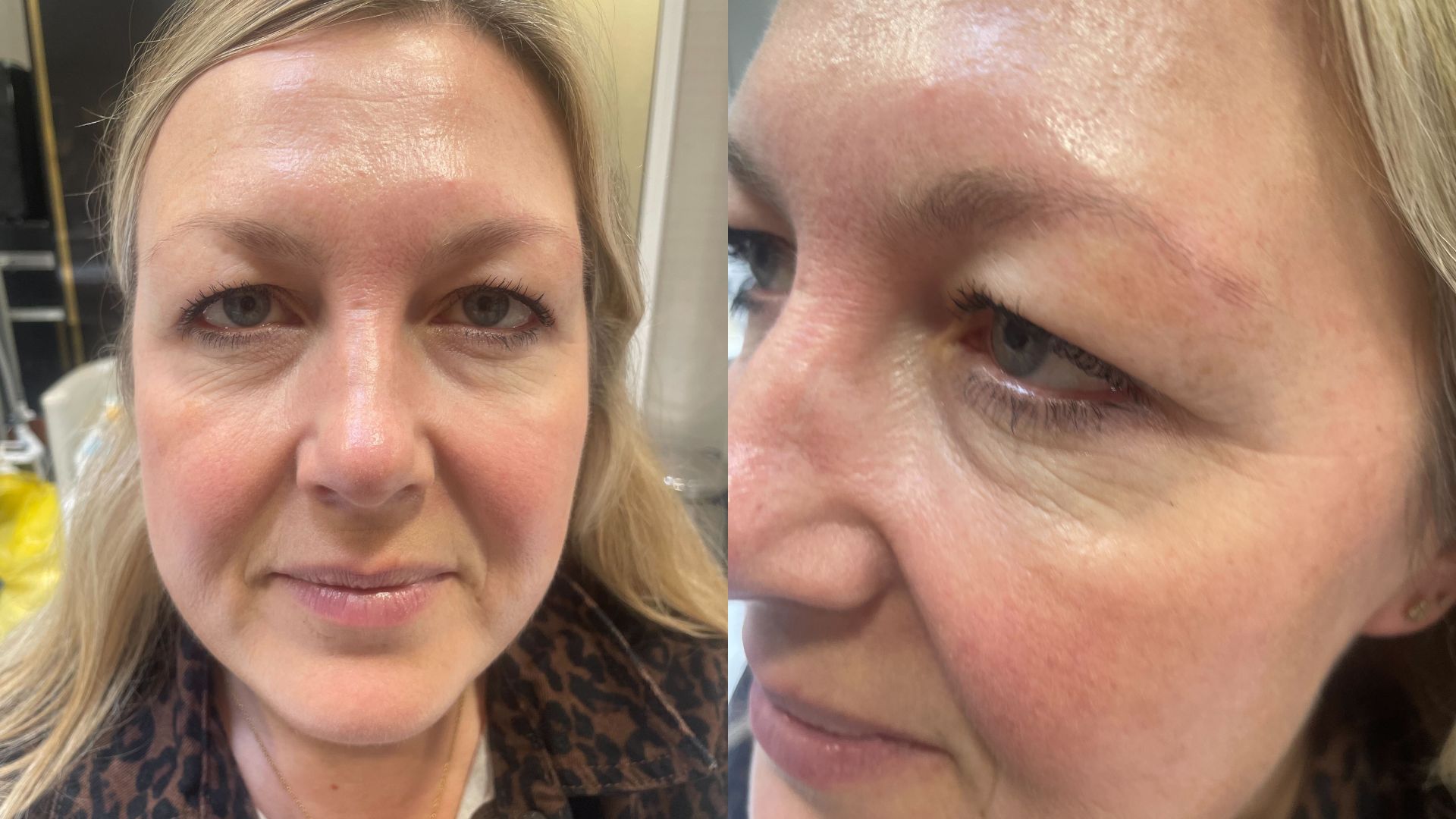 Sata Cooper White before and during microblading photos